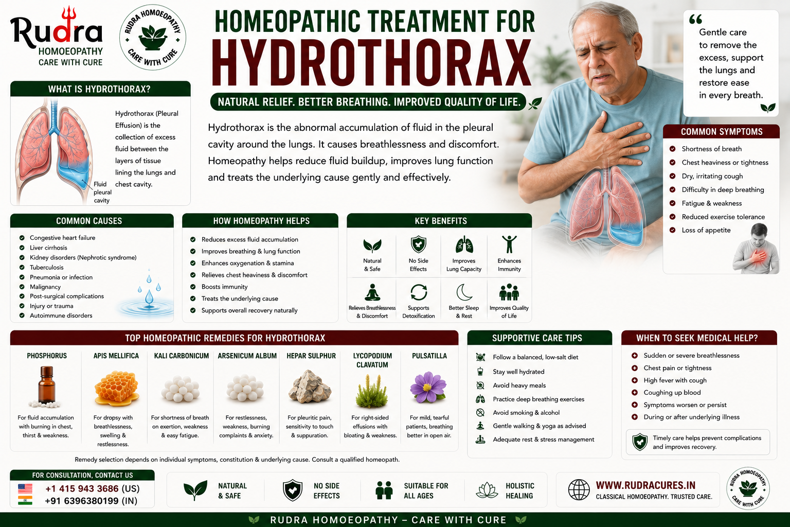 hydrothorax