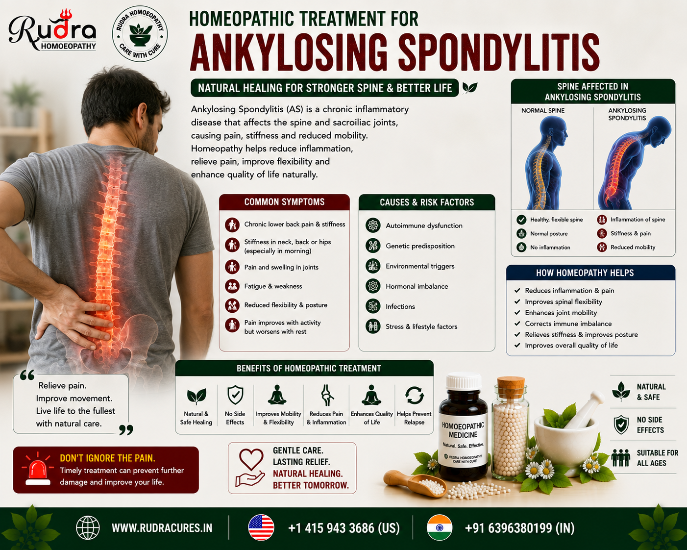 Homeopathic remedies for ankylosing spondylitis, HLA-B27 back pain, morning stiffness, bamboo spine prevention, and chest expansion