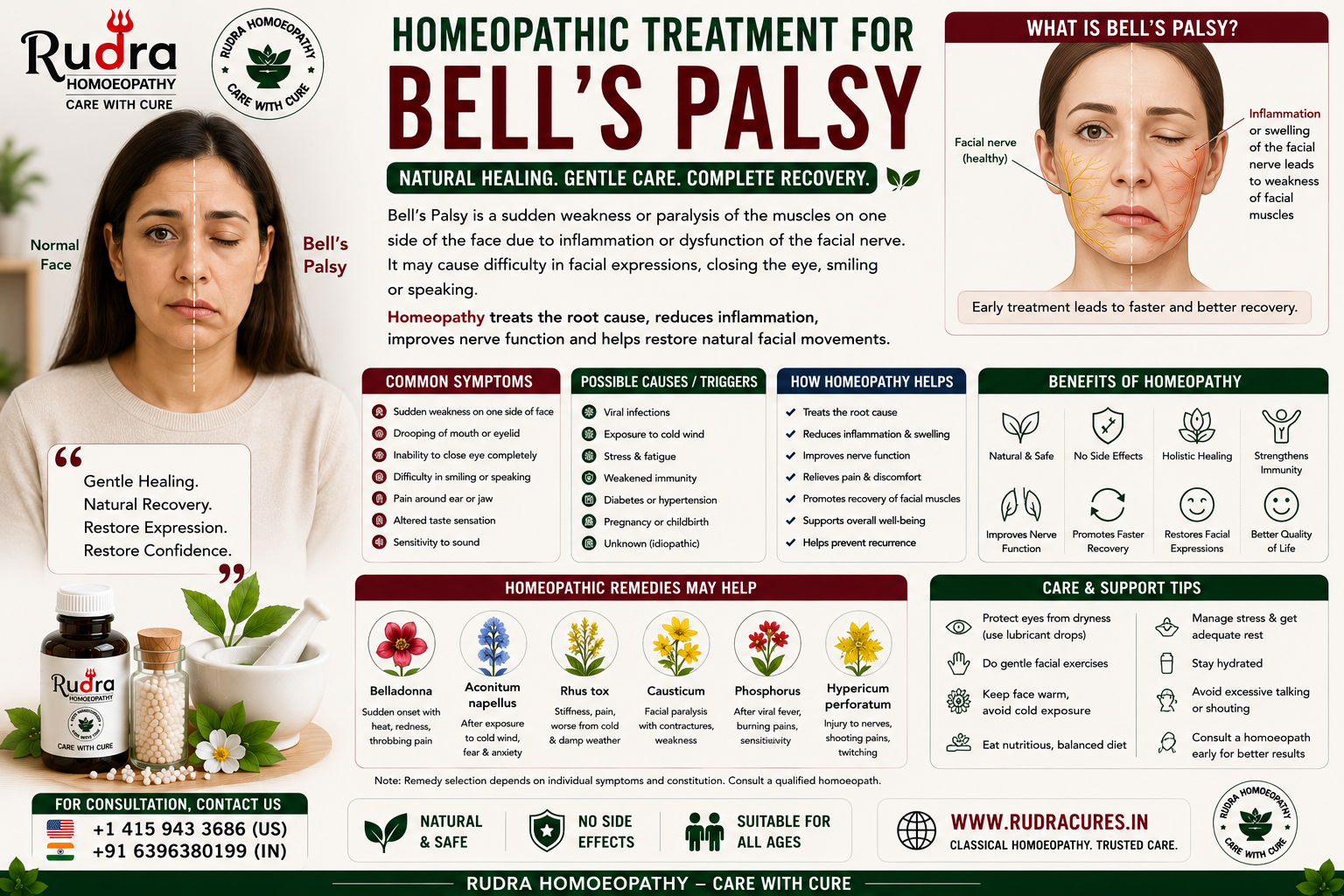 Homeopathic remedies for facial nerve palsy, drooping mouth, inability to close eye, hyperacusis, and post-viral nerve regeneration