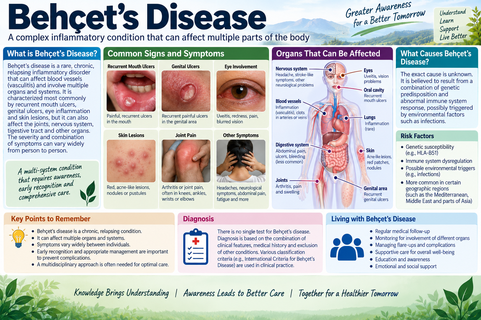 Homeopathic medicine for Behçet’s disease showing systemic vasculitis care, oral ulcer relief, and natural immunological wellness