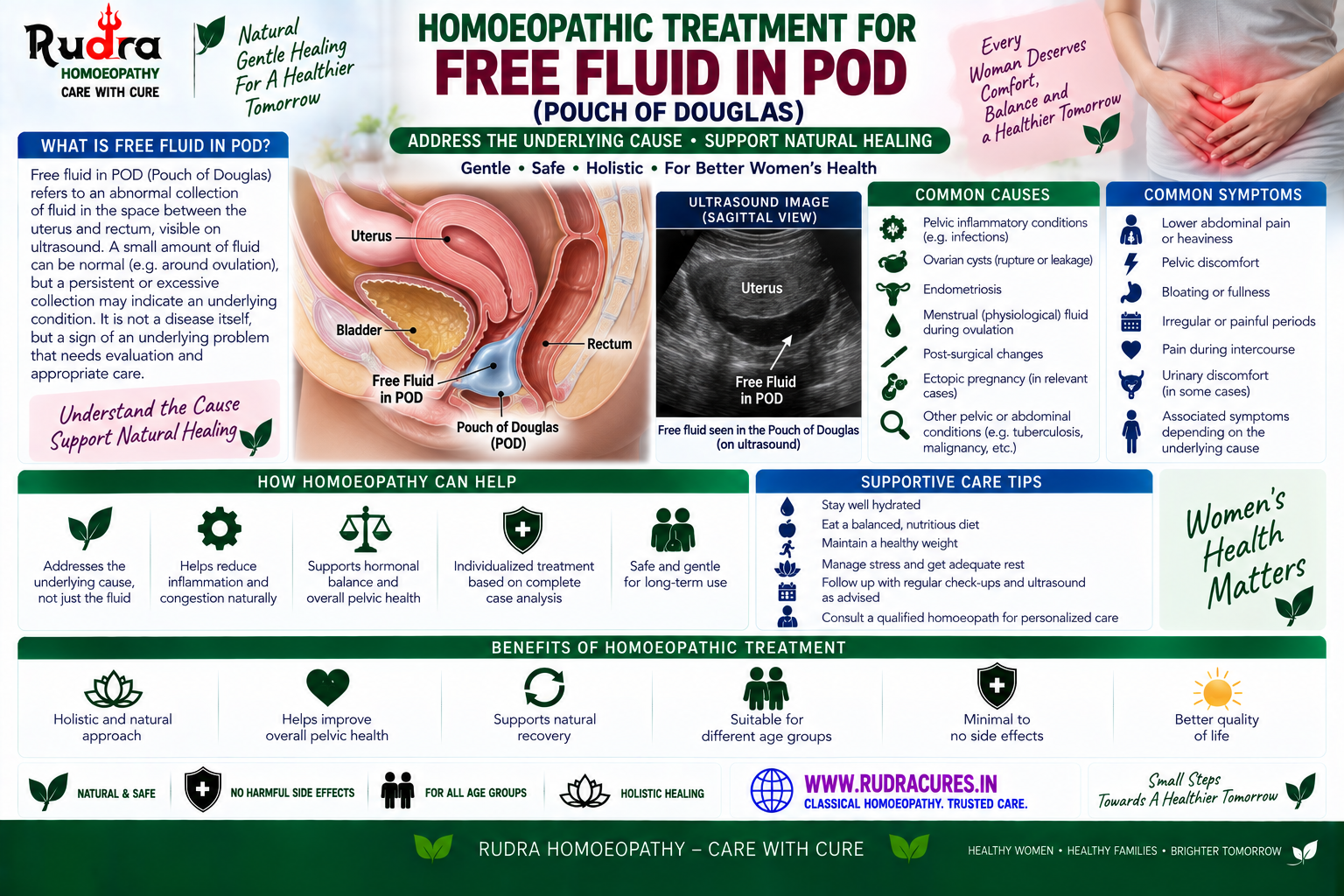 Homeopathic remedies for free fluid in POD, pelvic inflammatory disease, ruptured ovarian cyst, apis mellifica, cantharis, and medorrhinum