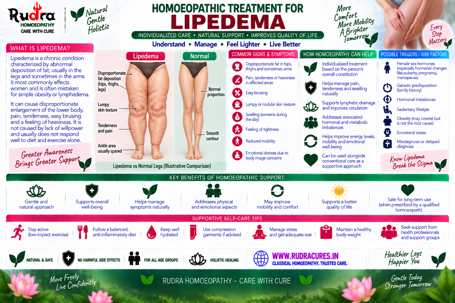 Homeopathic medicine for lipedema showing lymphatic drainage, adipose tissue care, and natural swelling relief