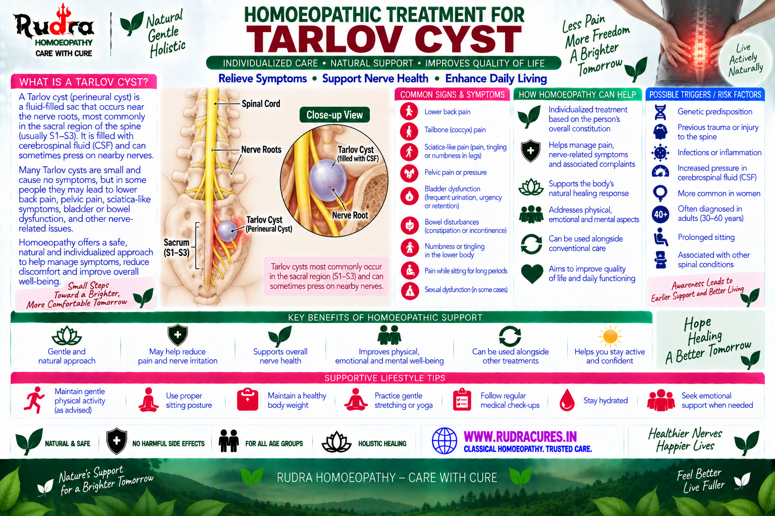 Homeopathic medicine for Tarlov cyst showing perineural cyst care, spinal nerve root decompression, and natural pain relief